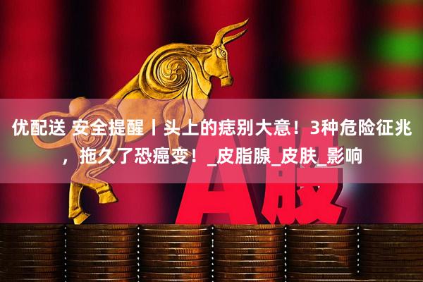 优配送 安全提醒丨头上的痣别大意！3种危险征兆，拖久了恐癌变！_皮脂腺_皮肤_影响